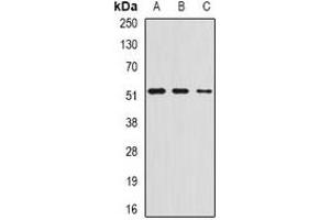 Western blot analysis of AMCase expression in HepG2 (A), mouse stomach (B), rat lung (C) whole cell lysates. (CHIA Antikörper)