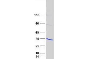 Western Blotting (WB) image for Regulator of G-Protein Signalling 19 (RGS19) (Transcript Variant 2) protein (Myc-DYKDDDDK Tag) (ABIN2730825)