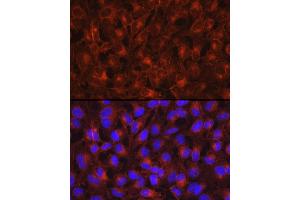 Immunofluorescence analysis of HeLa cells using Axl Rabbit pAb (ABIN7265804) at dilution of 1:200 (40x lens). (AXL Antikörper)