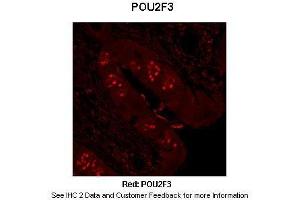 Immunohistochemistry (IHC) image for anti-POU Class 2 Homeobox 3 (POU2F3) (N-Term) antibody (ABIN2779706)