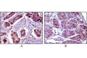 Immunohistochemistry (IHC) image for anti-B-Cell CLL/lymphoma 10 (BCL10) antibody (ABIN1105500) (BCL10 Antikörper)