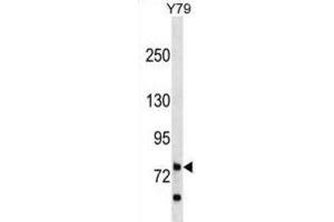 Western Blotting (WB) image for anti-Rhophilin, rho GTPase Binding Protein 1 (RHPN1) antibody (ABIN3000053) (RHPN1 Antikörper)