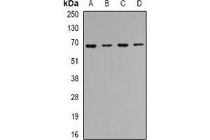 Western blot analysis of CIP4 expression in Hela (A), SKOV3 (B), mouse kidney (C), mouse heart (D) whole cell lysates. (TRIP10 Antikörper)