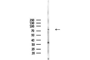 Western blot analysis of lysates from  cells(starvation,24h treatment), using ZNF225 Antibody at 1/1000 dilution.