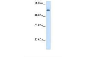 Image no. 1 for anti-Argininosuccinate Lyase (ASL) (AA 260-309) antibody (ABIN320665) (ASL Antikörper  (AA 260-309))