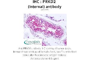 Image no. 1 for anti-Protein Kinase D2 (PKD2) (Internal Region) antibody (ABIN1738346) (PKD2 Antikörper  (Internal Region))