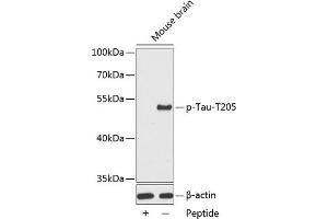Western blot analysis of extracts from mouse brain tissue, using phospho-Tau-T205 antibody (ABIN3019697, ABIN3019698, ABIN3019699 and ABIN7101862). (MAPT Antikörper  (pThr205))