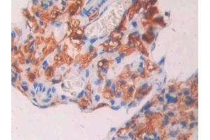 Detection of CA7 in Mouse Ovary Tissue using Polyclonal Antibody to Carbonic Anhydrase VII (CA7) (CA7 Antikörper  (AA 58-217))