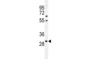 PHOX2B antibody western blot analysis in mouse liver tissue lysate (PHOX2B Antikörper  (AA 104-130))