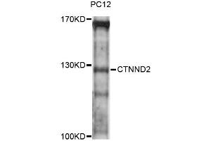 Western blot analysis of extracts of PC-12 cells, using CTNND2 antibody (ABIN6293310) at 1:3000 dilution. (CTNND2 Antikörper)