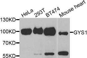 Western blot analysis of extracts of various cell lines, using GYS1 antibody (ABIN5971351) at 1/1000 dilution. (Glycogen Synthase 1 Antikörper)