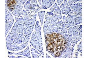 Immunohistochemistry (IHC) image for anti-Interleukin 17A (IL17A) (AA 26-158) antibody (ABIN5692879)