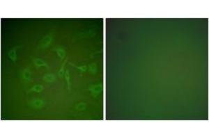 Immunofluorescence analysis of HepG2 cells, using Mammaglobin Antibody. (Mammaglobin Antikörper  (AA 41-90))