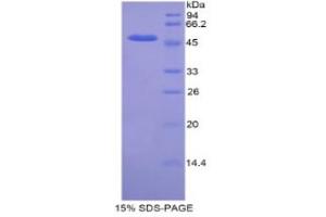 SDS-PAGE analysis of Mouse KIF5A Protein. (KIF5A Protein)