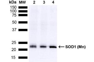 Western blot analysis of Mouse Brain, Rat Brain, and Rat Brain Membrane showing detection of 24. (SOD2 Antikörper  (Biotin))