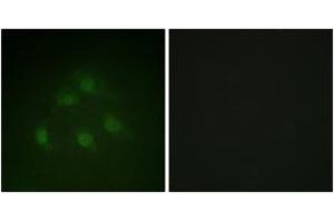 Immunofluorescence analysis of HeLa cells, using Smad1 (Ab-187) Antibody. (SMAD1 Antikörper  (AA 153-202))