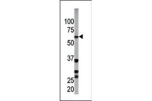 Image no. 1 for anti-SMAD, Mothers Against DPP Homolog 3 (SMAD3) (pSer208) antibody (ABIN358225) (SMAD3 Antikörper  (pSer208))
