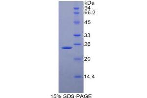 SDS-PAGE analysis of Rat Fibulin 2 Protein.