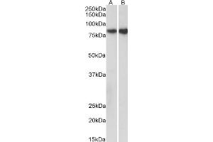 Western Blotting (WB) image for anti-Cadherin 1, Type 1, E-Cadherin (Epithelial) (CDH1) (AA 662-675) antibody (ABIN870690)