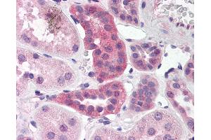 Anti-RPAIN antibody IHC of human kidney. (RPAIN Antikörper  (C-Term))