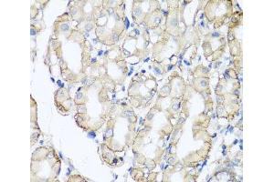 Immunohistochemistry of paraffin-embedded Human stomach using AHCYL1 Polyclonal Antibody at dilution of 1:100 (40x lens). (AHCYL1 Antikörper)