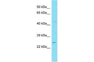 Host: Rabbit Target Name: WFDC3 Sample Type: 721_B Whole Cell lysates Antibody Dilution: 1. (WFDC3 Antikörper  (N-Term))