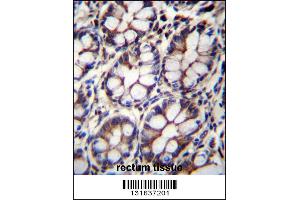 IQCA1 Antibody immunohistochemistry analysis in formalin fixed and paraffin embedded human rectum tissue followed by peroxidase conjugation of the secondary antibody and DAB staining. (IQCA1 Antikörper  (C-Term))