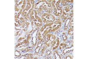 Immunohistochemistry (IHC) image for anti-Dihydrolipoyl Transacetylase (DLAT) (AA 87-270) antibody (ABIN7266768)