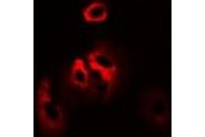 Immunofluorescent analysis of RPS7 staining in SW480 cells. (RPS7 Antikörper)