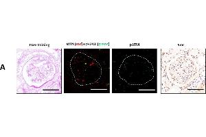 Immunofluorescence (Paraffin-embedded Sections) (IF (p)) image for anti-Ataxia Telangiectasia Mutated (ATM) (AA 1974-1988), (pSer1981) antibody (ABIN6656104)