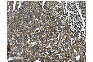 IHC analysis of Clathrin heavy chain/CLTC using anti-Clathrin heavy chain/CLTC antibody (ABIN7602704). (Clathrin Heavy Chain (CLTC) (AA 967-1668) Antikörper)