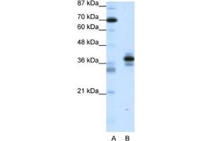 Western Blotting (WB) image for anti-Paired-Like Homeodomain 1 (PITX1) antibody (ABIN2461668) (PITX1 Antikörper)