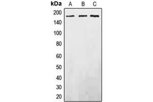 Western blot analysis of EGFR expression in DLD (A), SP2/0 (B), PC12 (C) whole cell lysates. (EGFR Antikörper  (C-Term))