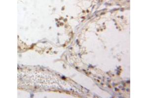 IHC-P analysis of Testis tissue, with DAB staining. (Down Regulator Of Transcription 1, TBP Binding (AA 2-170) Antikörper)