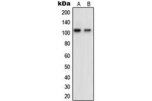 Western blot analysis of OCRL expression in HeLa (A), KNRK (B) whole cell lysates. (OCRL Antikörper  (Center))