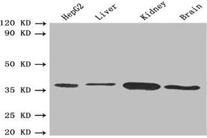 Western Blotting (WB) image for anti-3-hydroxybutyrate Dehydrogenase, Type 1 (BDH1) (AA 47-343) antibody (ABIN7149458)