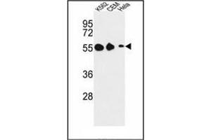 Western blot analysis of GALR1 Antibody (Center) in K562, CEM, Hela cell line lysates (35ug/lane). (Galanin Receptor 1 Antikörper  (Middle Region))