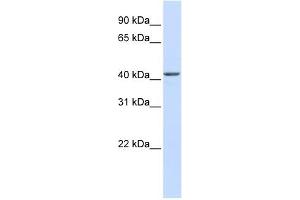 NOB1 antibody used at 1 ug/ml to detect target protein. (NOB1 Antikörper)