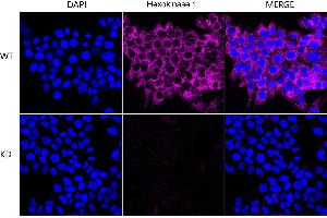 Immunocytochemical staining of HeLa cells using Hexokinase 1 antibody (ABIN7798906), 1:1,000), Top panel: wild-type (WT), Bottom panal: Hexokinase 1 shRNA knockdown (KD). (Rekombinanter Hexokinase 1 Antikörper)