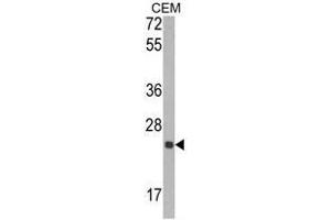 Western blot analysis of TIMP1 Antibody (N-term) in CEM cell line lysates (35ug/lane).