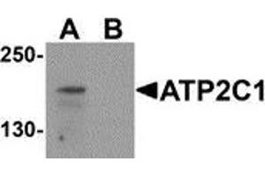 Western blot analysis of ATP2C1 in mouse brain tissue lysate with ATP2C1 antibody at 1 μg/ml in (A) the absence and (B) the presence of blocking peptide (ATP2C1 Antikörper  (C-Term))
