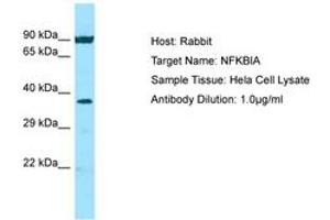 Image no. 1 for anti-Nuclear Factor of kappa Light Polypeptide Gene Enhancer in B-Cells Inhibitor, alpha (NFKBIA) (N-Term) antibody (ABIN6749808) (NFKBIA Antikörper  (N-Term))