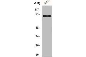 Western Blot analysis of HeLa cells using Phospho-Rad17 (S645) Polyclonal Antibody (RAD17 Antikörper  (pSer645))