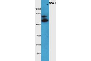 Lane 1: rat brain lysates probed with Rabbit Anti-VAT Polyclonal Antibody, Unconjugated (ABIN735113) at 1:300 overnight at 4 °C. (SLC18A3 Antikörper  (AA 201-300))