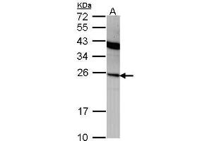 WB Image Sample (30 ug of whole cell lysate) A: A431 , 12% SDS PAGE antibody diluted at 1:1000 (IFNA2 Antikörper  (C-Term))