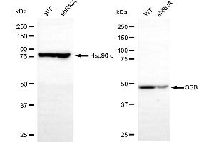 Western blotting analysis using SSB antibody (ABIN7800357). (SSB Antikörper)