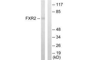 Western blot analysis of extracts from COLO205 cells, using FXR2 antibody. (FXR2 Antikörper)