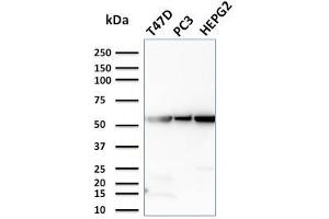 Western Blot Analysis of T47D, PC3, HePG2 cell lysates using GPI Mouse Monoclonal Antibody (CPTC-GPI-1). (GPI Antikörper)