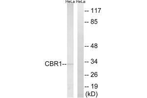Western blot analysis of extracts from HeLa cells, using CBR1 antibody. (CBR1 Antikörper  (Internal Region))