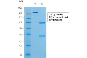 SDS-PAGE Analysis of Purified Thyroglobulin Mouse Recombinant Monoclonal Antibody (r6E1).